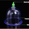 cupping therapy set