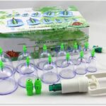 cupping therapy set