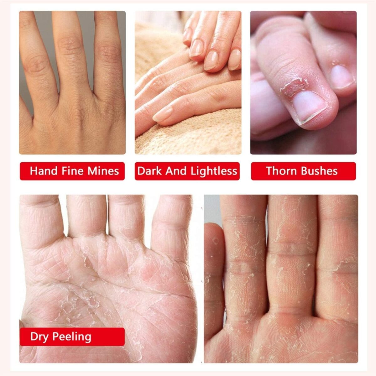 hand repair